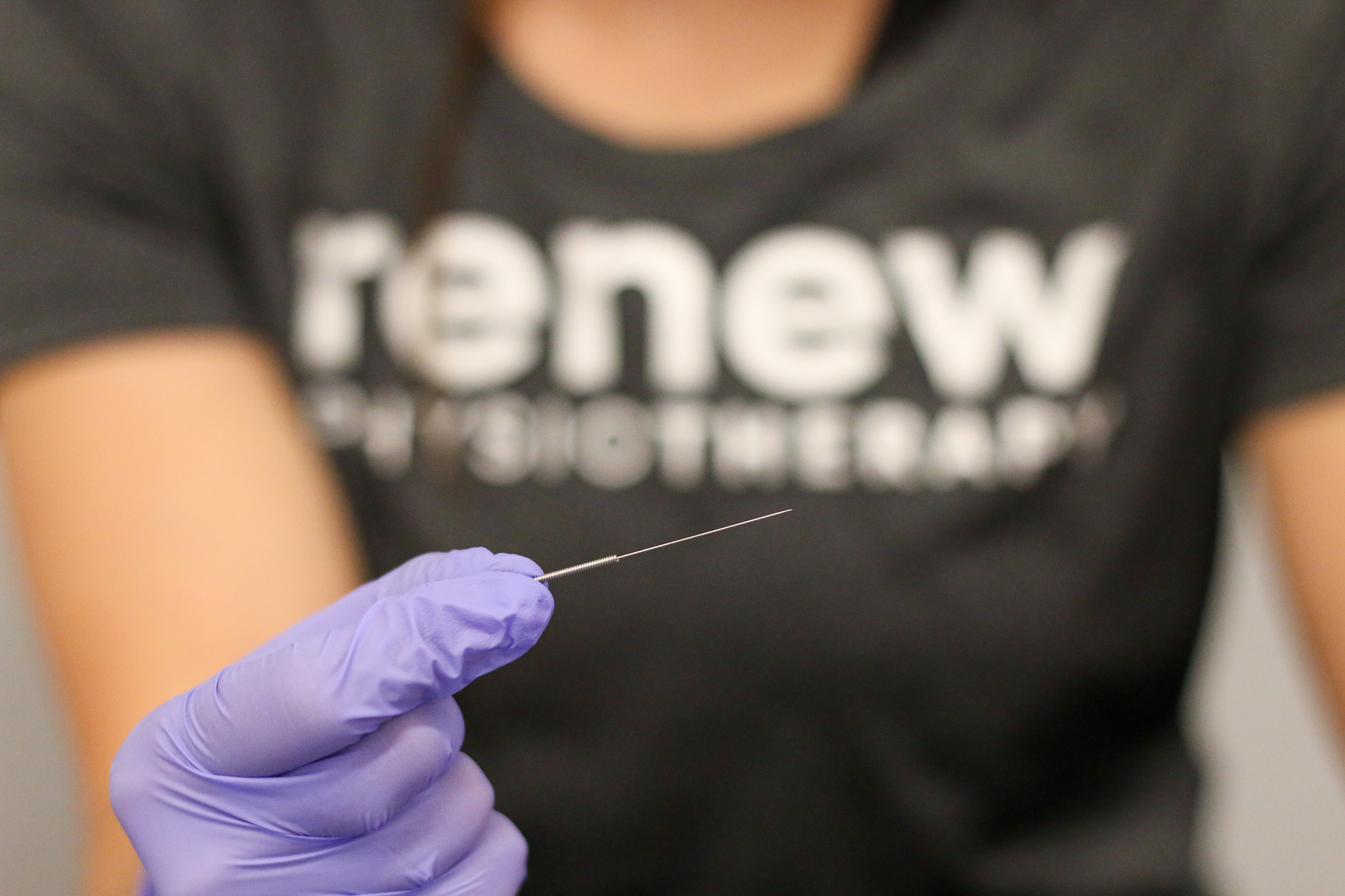 Dry Needling